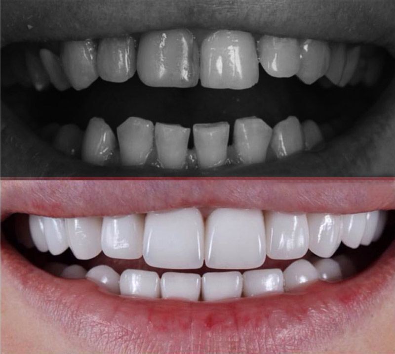 Чистка зубов улан удэ. Стоматология Одонт Улан-Удэ. Дент студио стоматология Улан-Удэ фото. Ломаются зубы после родов.